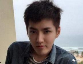 吴亦凡牙齿前后照片,从隐秘矫正到自信微笑的华丽转身  第3张